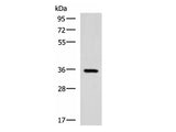 B3GAT1 Polyclonal Antibody Reactivity Rat