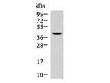 KLF6 Polyclonal Antibody Reactivity Human