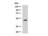 TP53 Polyclonal Antibody