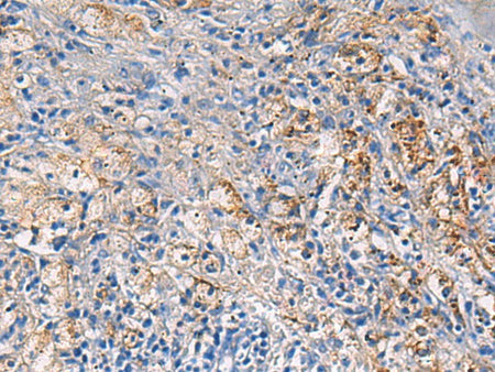 NFKB1 Polyclonal Antibody Reactivity Human