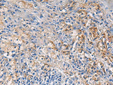 NFKB1 Polyclonal Antibody Reactivity Human