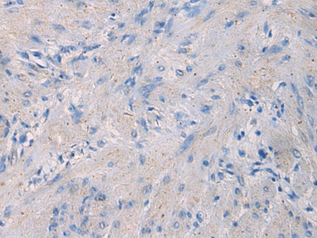 NFKB1 Polyclonal Antibody Reactivity Human