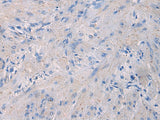 NFKB1 Polyclonal Antibody Reactivity Human