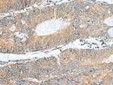 NFKB1 Polyclonal Antibody Human