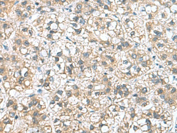 NFKB1 Polyclonal Antibody Human