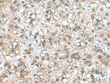 NFKB1 Polyclonal Antibody Human