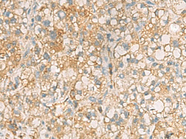ANXA13 Polyclonal Antibody
