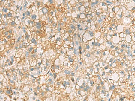 ANXA13 Polyclonal Antibody