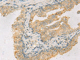 ANXA13 Polyclonal Antibody
