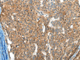 FTL Polyclonal Antibody