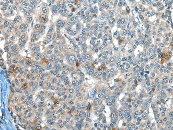 CAPN3 Polyclonal Antibody Reactivity Mouse