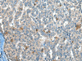 CAPN3 Polyclonal Antibody Reactivity Mouse