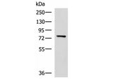CAPN5 Polyclonal Antibody Reactivity Human