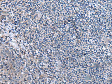 CCK Polyclonal Antibody Reactivity Human