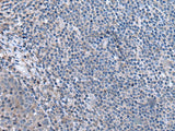 CCK Polyclonal Antibody Reactivity Human