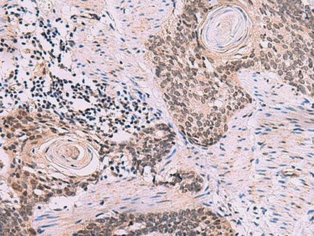 CDK4 Polyclonal Antibody Reactivity Human
