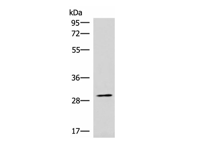 CDK4 Polyclonal Antibody Reactivity Human