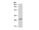 CDK4 Polyclonal Antibody Reactivity Human