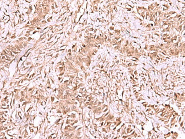 CDKN1B Polyclonal Antibody Reactivity Mouse