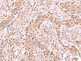 CDKN1B Polyclonal Antibody Reactivity Mouse