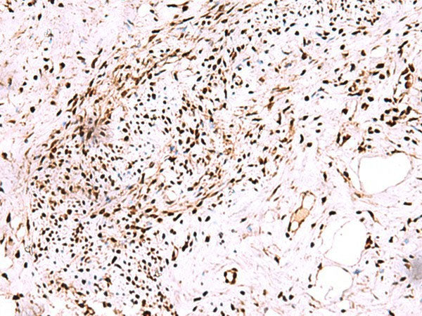 CDKN1B Polyclonal Antibody Reactivity Mouse