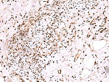 CDKN1B Polyclonal Antibody Reactivity Mouse