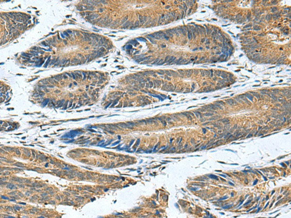 CLEC1B Polyclonal Antibody Reactivity Human