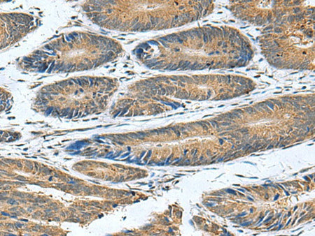 CLEC1B Polyclonal Antibody Reactivity Human
