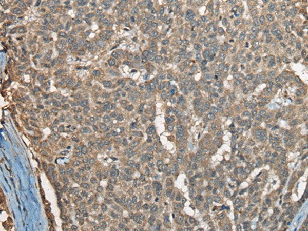 COX7A2L Polyclonal Antibody Reactivity Human