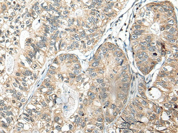 SLAMF7 Polyclonal Antibody Reactivity Human