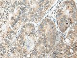 SLAMF7 Polyclonal Antibody Reactivity Human