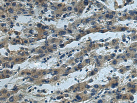 CUL5 Polyclonal Antibody