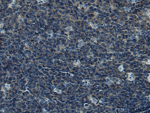 CUL5 Polyclonal Antibody