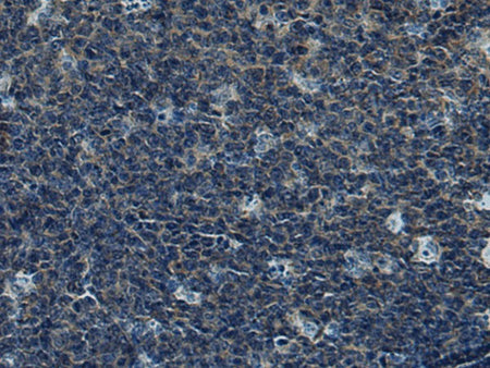 CUL5 Polyclonal Antibody