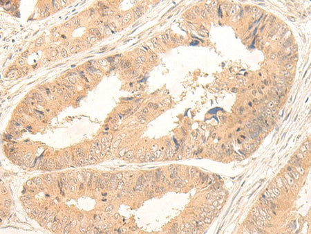 FABP4 Polyclonal Antibody Reactivity Human