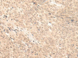 FABP4 Polyclonal Antibody Reactivity Human