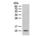 FABP4 Polyclonal Antibody Reactivity Human