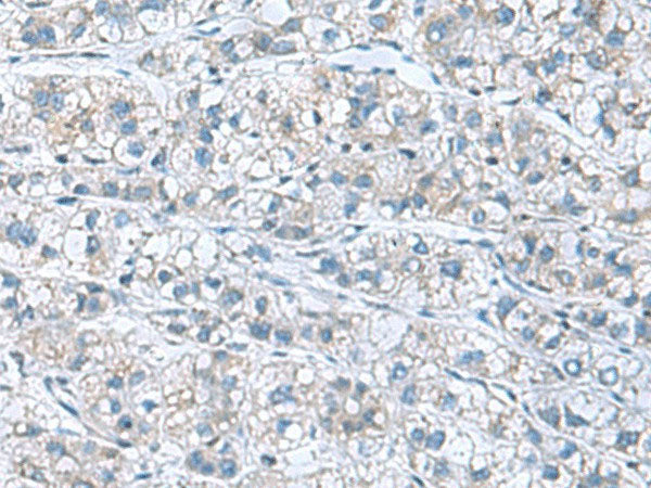 GDF9 Polyclonal Antibody