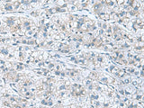 GDF9 Polyclonal Antibody
