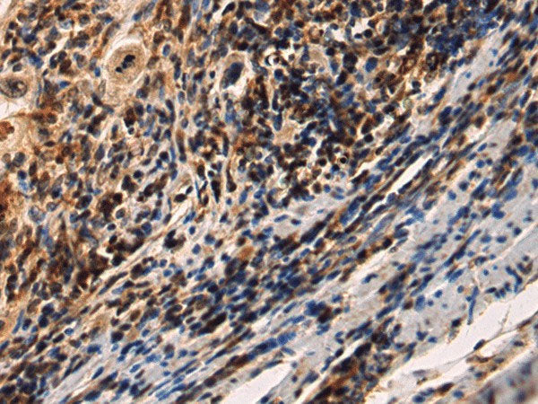 IRAK2 Polyclonal Antibody Reactivity Human