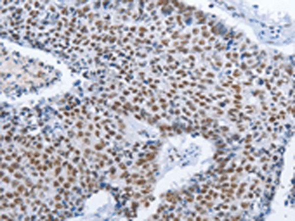 GNRH1 Polyclonal Antibody Reactivity Human