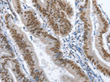 GNRH1 Polyclonal Antibody Reactivity Human