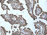 MCM10 Polyclonal Antibody Reactivity Mouse