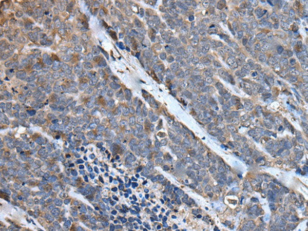 MCM10 Polyclonal Antibody Reactivity Mouse