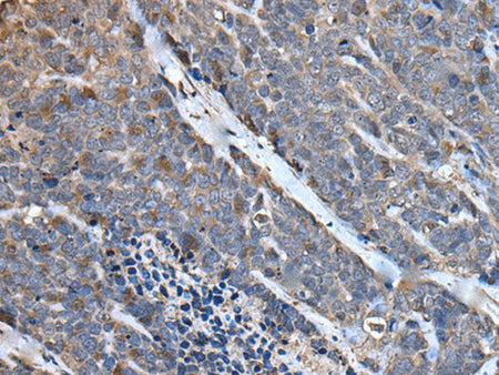 MCM10 Polyclonal Antibody Reactivity Mouse