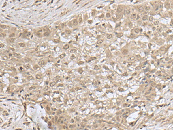 NEUROG3 Polyclonal Antibody Reactivity Human