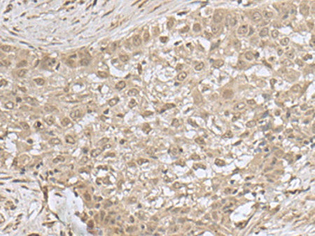 NEUROG3 Polyclonal Antibody Reactivity Human