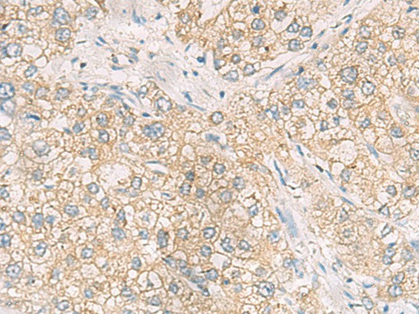 MAPK14 Polyclonal Antibody Reactivity Mouse
