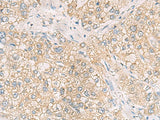 MAPK14 Polyclonal Antibody Reactivity Mouse