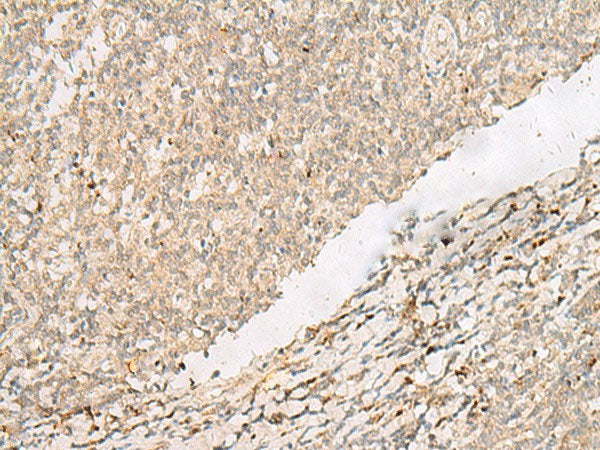 PADI4 Polyclonal Antibody Reactivity Human